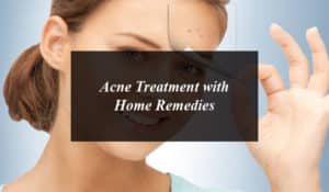 Acne Treatment with Home Remedies
