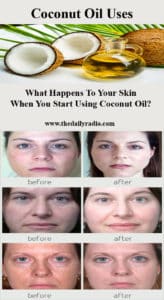 What Happens To Your Skin When You Start Using Coconut Oil?