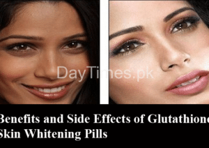 Benefits and Side Effects of Glutathione Skin Whitening Pills