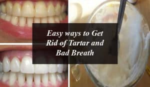 Easy ways to Get Rid of Tartar and Bad Breath