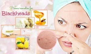 How to Remove Blackheads? Best Blackhead Removal Products in USA