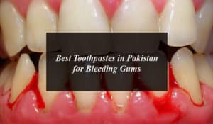 Best Toothpastes in Pakistan for Bleeding Gums