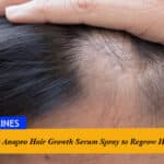 How to Use Anapro hair Growth Serum Spray to Regrow Hair?