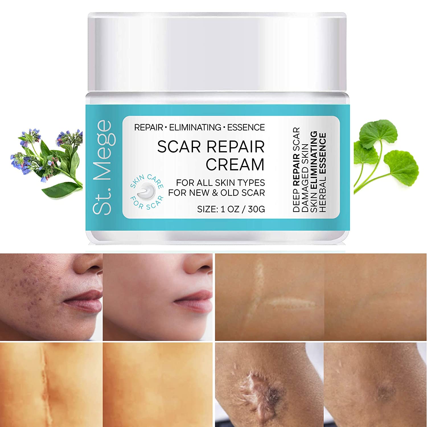 Scar Cream - Homecare24